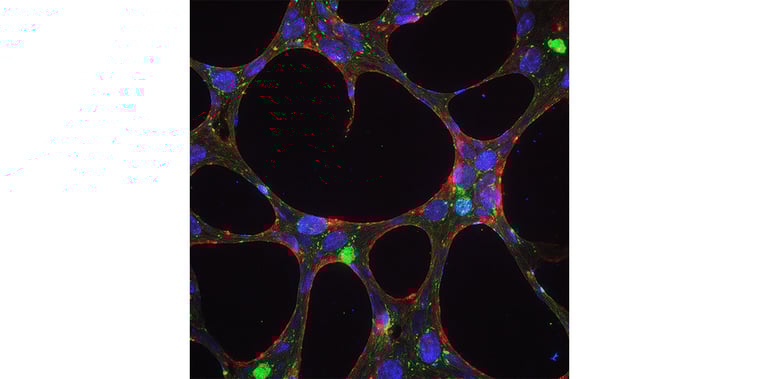 Organoid Brain Image